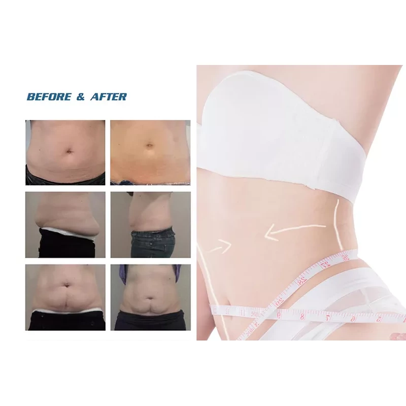 2022 Factory Sale 360 Cryolipolysis Slimming Machine / Fat Freezing Machine Cool Tech Cellulite Reduction