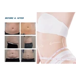 2022 Factory Sale 360 Cryolipolysis Slimming Machine / Fat Freezing Machine Cool Tech Cellulite Reduction