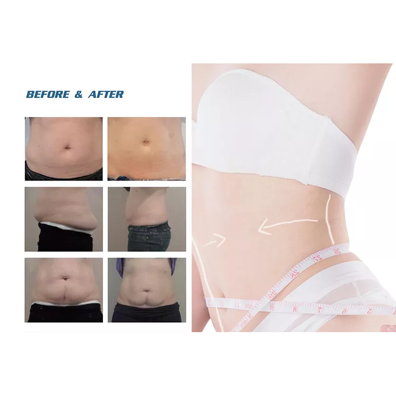 2022 Factory Sale 360 Cryolipolysis Slimming Machine / Fat Freezing Machine Cool Tech Cellulite Reduction