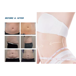 2022 Factory Sale 360 Cryolipolysis Slimming Machine / Fat Freezing Machine Cool Tech Cellulite Reduction