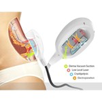 Best price cryolipolysis slimming machine cryotherapy weight lose fat freezing