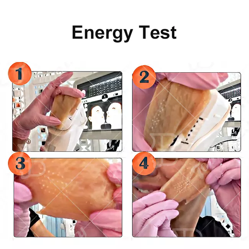 360 ° rotate display ultrasound skin rejuvenation Wrinkle Removal vertical 4D MMFU Machine