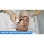 12D ICE hifu machine face lifting hifu Skin tighten HIFU machine