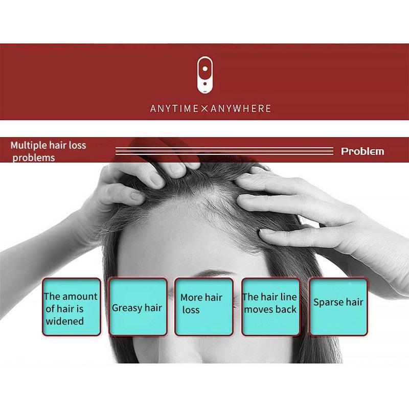 Portable Mini Electric Ionic Hair Brush Anti-Static Scalp Head Massage Comb Hair loss machine treatment Care