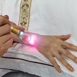 980nm Laser Class 4 Therapy Physiotherapy Cold Laser Healing Machine