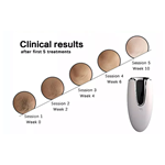 Home use trending products Hand held Hair Removal Laser Machine At Home Laser Hair Removal Portable