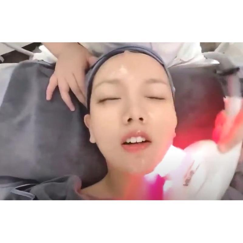 1300nm Nir Nearlight Milk Light Skin Rejuvenation Pulse Machine