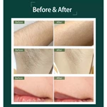 Drop Shipping Home Use 5th Gear Quartz Tube Mini Hair Removal Appliances Permanent Ipl Hair Removal Device Handset