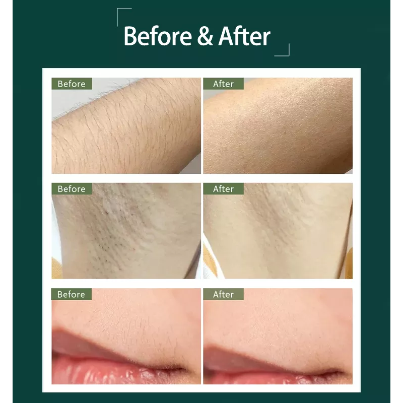 Drop Shipping Home Use 5th Gear Quartz Tube Mini Hair Removal Appliances Permanent Ipl Hair Removal Device Handset