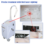 Q Switch Nd Yag Laser Pico Laser Pigment Tattoo Removal Machine