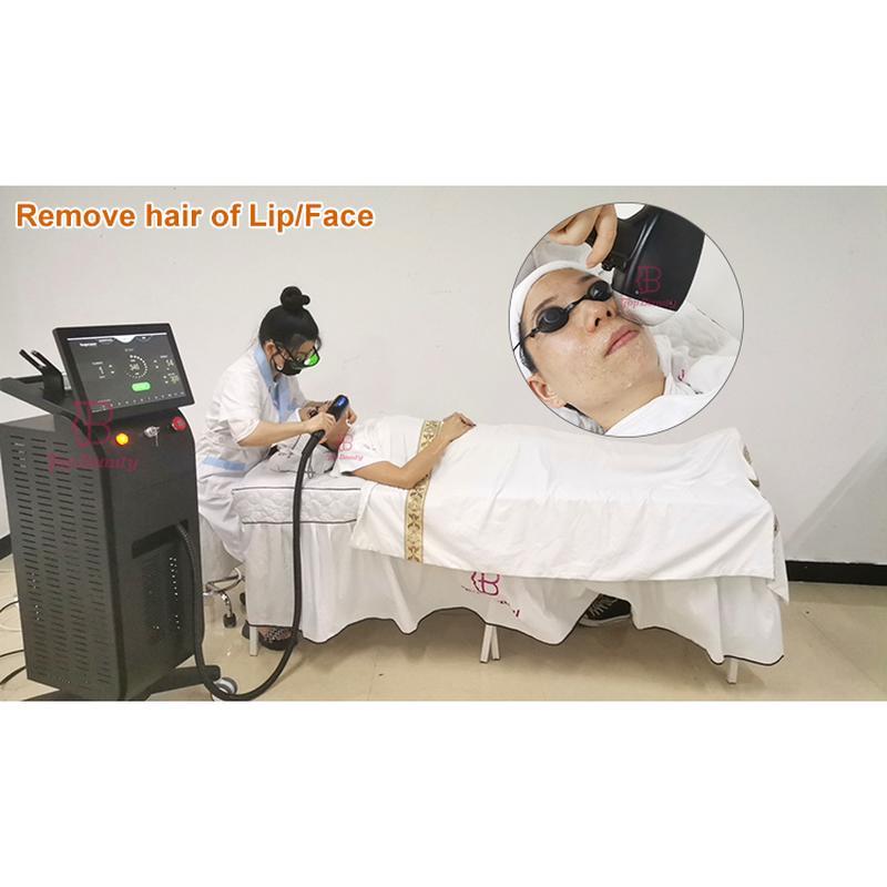 professional 808nm Diode laser hair removal machine