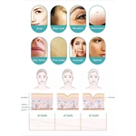 Professional Rf Microneedling Scarring Removal Skin Tightening Micro Needling Machine