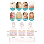 Professional Rf Microneedling Scarring Removal Skin Tightening Micro Needling Machine