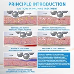 Cellulite Reduction Body Contouring Lymphatic Drainage 360 Rotating Slimming 6D Inner Ball Roller Massage