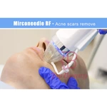 microneedling fractional rf microneedle machine