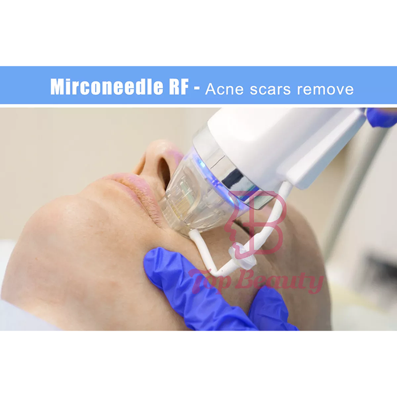 microneedling fractional rf microneedle machine