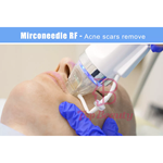 microneedling fractional rf microneedle machine