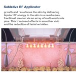 Radiofrequency (RF) Microneedling Matrix Pros skin wrinkle removal