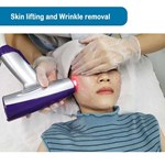 Radiofrequency (RF) Microneedling Matrix Pros skin wrinkle removal