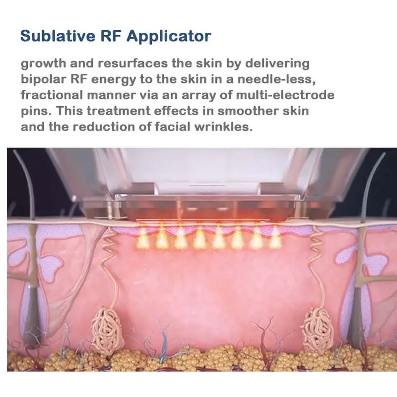 RF Micro-needle + Thermagia Fractional RF System Microneedling RF Fractional Radio Frequency Beauty Equipment