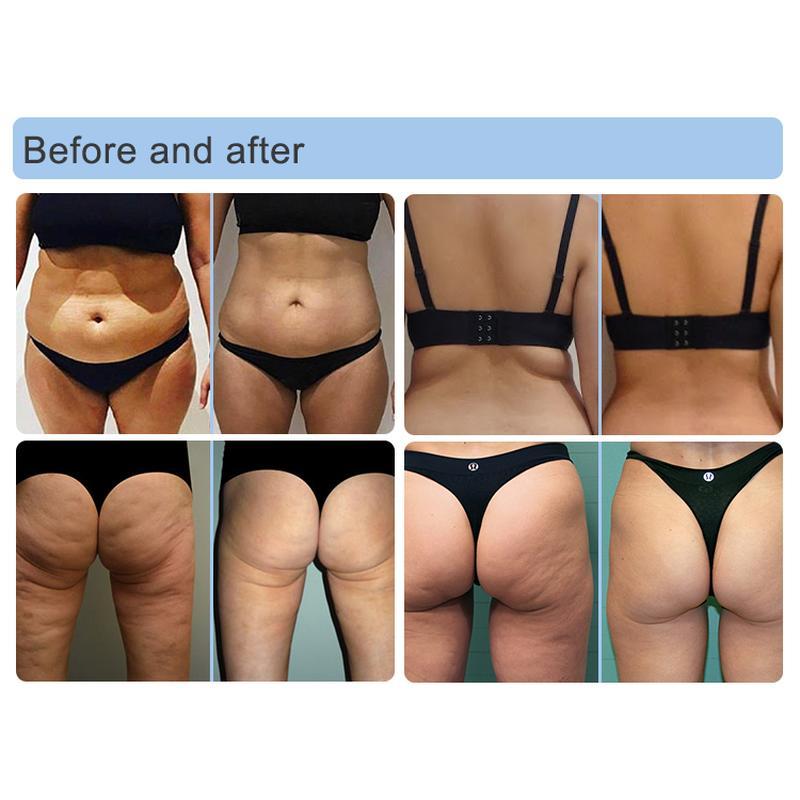 5D vacuum infrared roller cellulite reduction machine