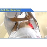 Endospheres roller massage cellulite machine