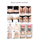 Professional Lymphatic Drainage Cellulite Reduction Roller Slimming Machine Massage Inner Ball Roller Weight Loss Machine