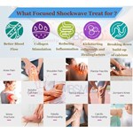 hot sale eswt ed focus shockwave system shock focused shockwave therapy machine,Shockwave Physical