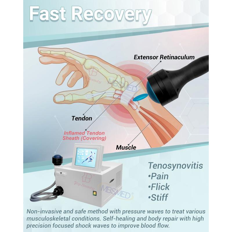 hot sale eswt ed focus shockwave system shock focused shockwave therapy machine,Shockwave Physical