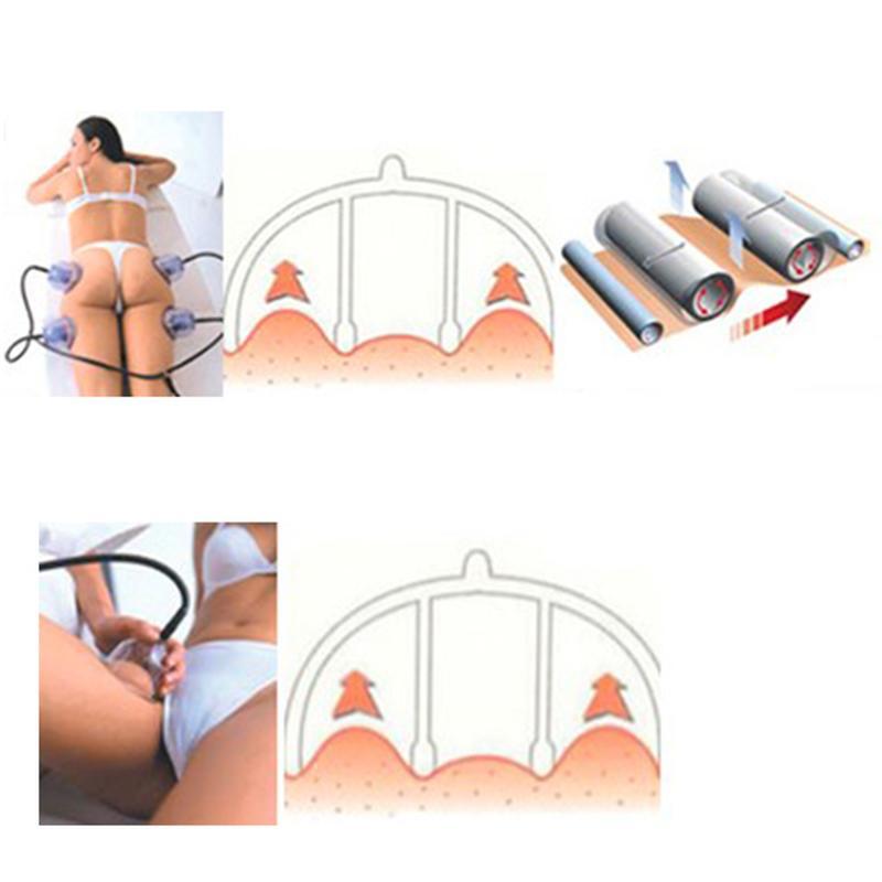 Starvac Sp2 Vacuum Therapy Massage Cupping Therapy Massager body slimming vacuum cup Machine