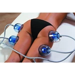 Starvac Sp2 Vacuum Therapy Massage Cupping Therapy Massager body slimming vacuum cup Machine