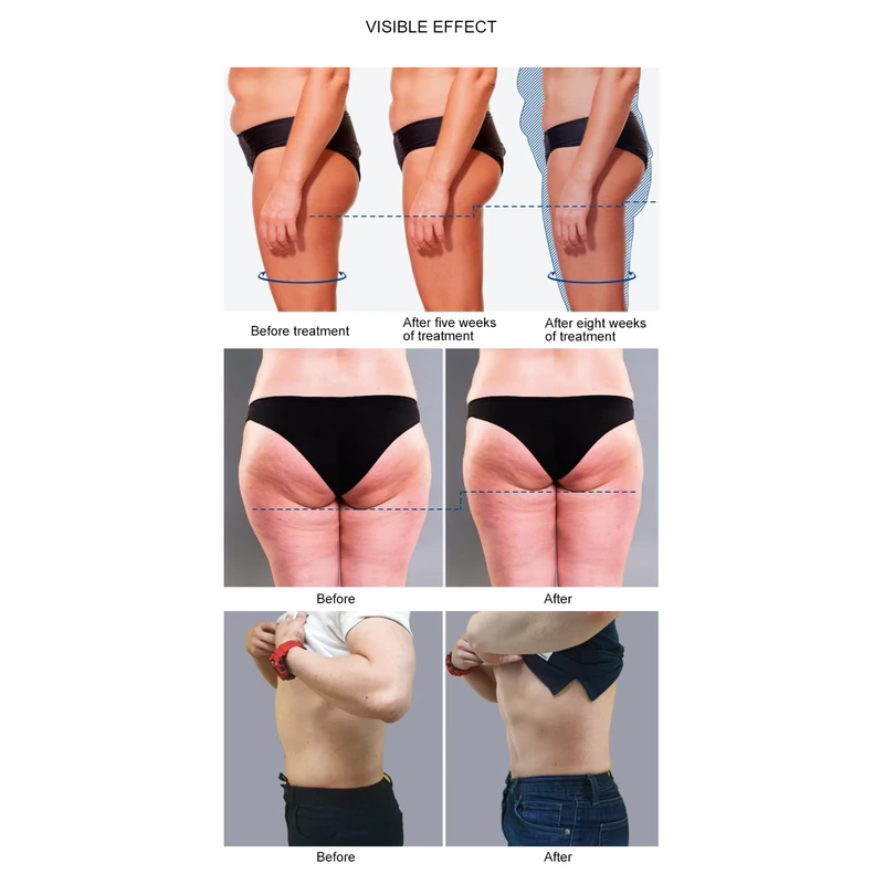 Professional Strong Power Portable Ems Body Slimming Muscle Stimulate Machine