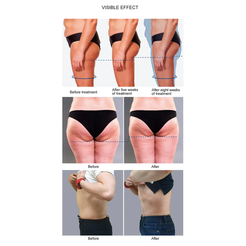 Professional Strong Power Portable Ems Body Slimming Muscle Stimulate Machine