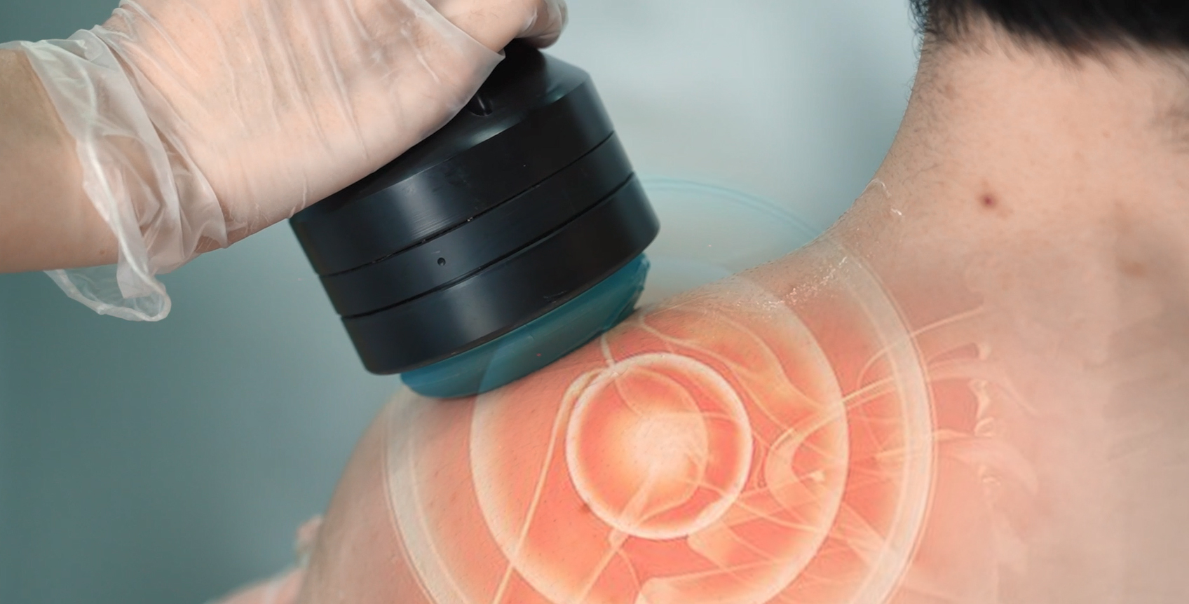 Focused Shockwave Therapy Machine for  Bone Healing & Pain Relief