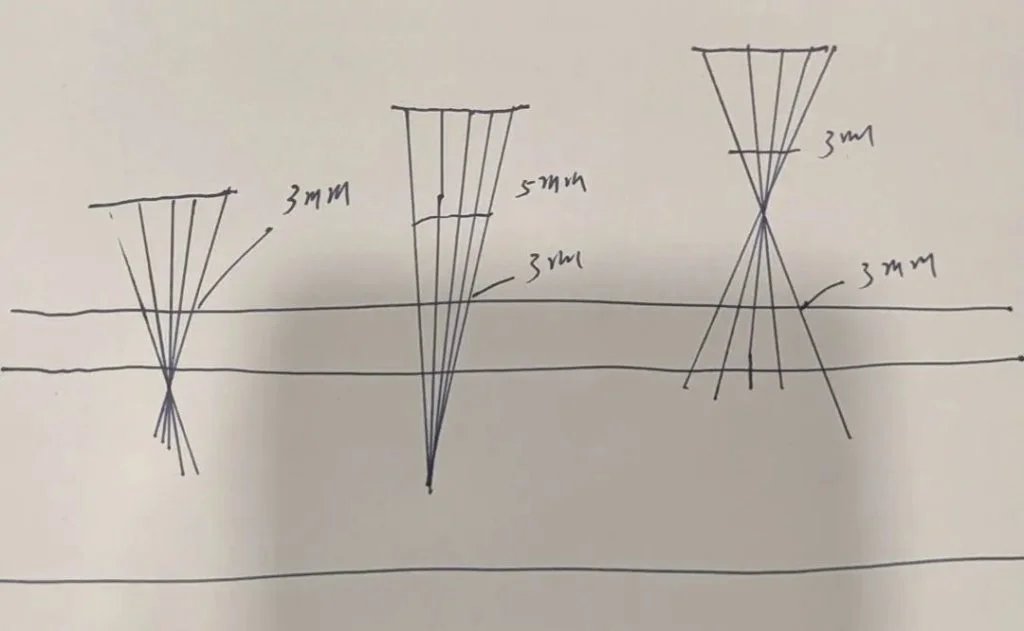 1064nm Laser Skin Beauty Application Case Discussion