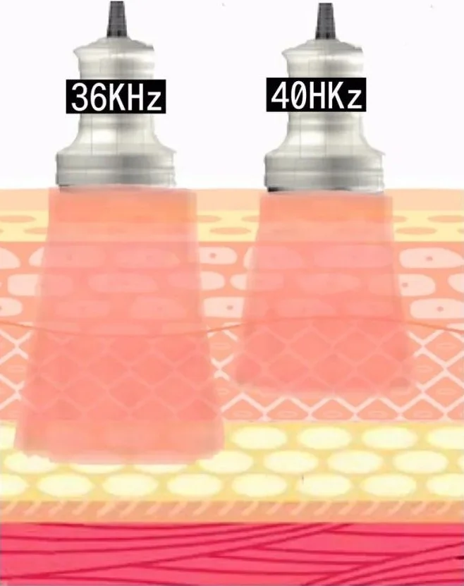 Skin depth pictures of different RF frequencies of cavitation machines