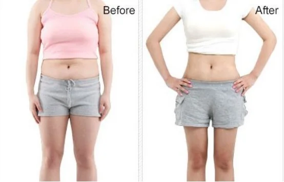 V12 slimming machine before and after weight loss treatment
