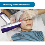 Rf Microneedle Scarring Removal Skin Tightening  Rf Microneedling Machine