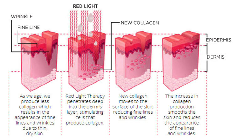 7 Color PDT Light Therapy Machine for Face Acne Care