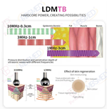 4 in 1 LDMTB RF Hot Cold Machine
