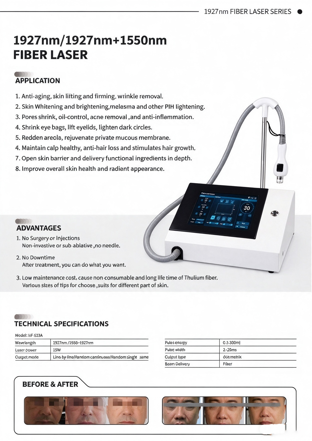 New Arrival 1927nm 1550nm Thulium Laser for Skin Rejuvenation Acne Remove