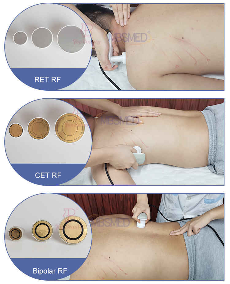 448khz  Back Pain Relief Chiropractic Tecar Therapy Machine