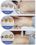 448khz  Back Pain Relief Chiropractic Tecar Therapy Machine