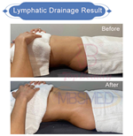 3 in 1 Infrared EMS Pressotherapy Body Slimming Suit  Lymphatic Drainage  Machine