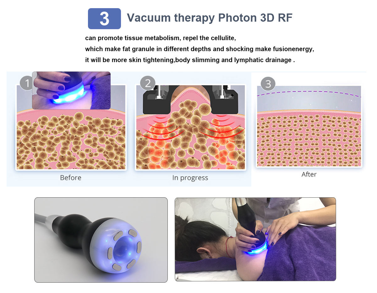 Portable Ultrasound Cavitation Radio Frequency EMS 40k Cavitation Machine