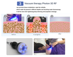 Portable Ultrasound Cavitation Radio Frequency EMS 40k Cavitation Machine