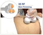 Vacuum Cellulite Rolling Fat Removal Portable Rf Fat Cavitation Machine 30k 40k