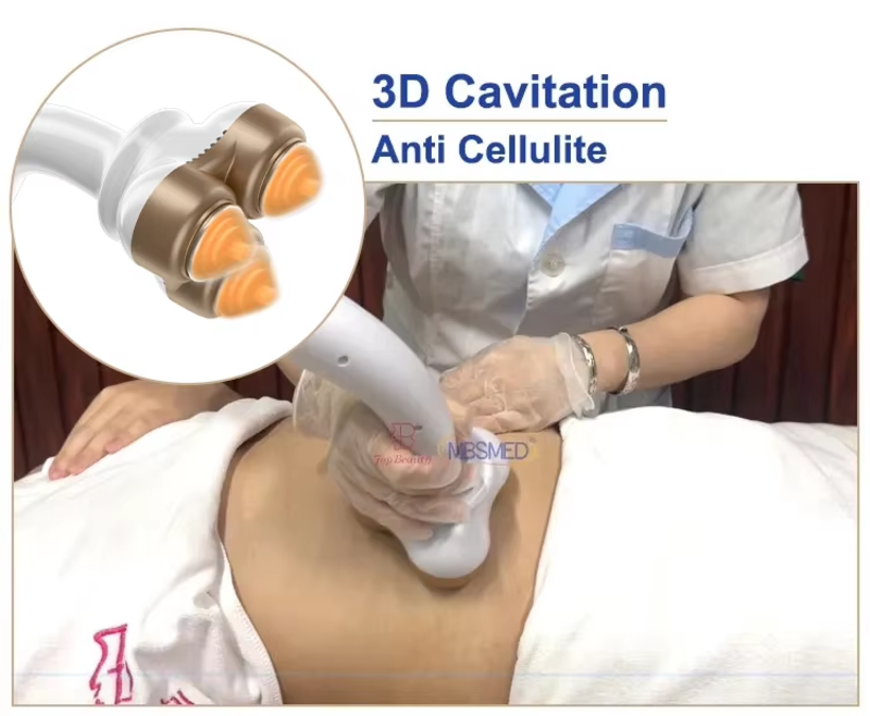 Vacuum Cellulite Rolling Fat Removal Portable Rf Fat Cavitation Machine 30k 40k