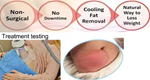 5 in 1 Cryolipolysys Fat Reduce 360 Cellulite Reduction  Machine