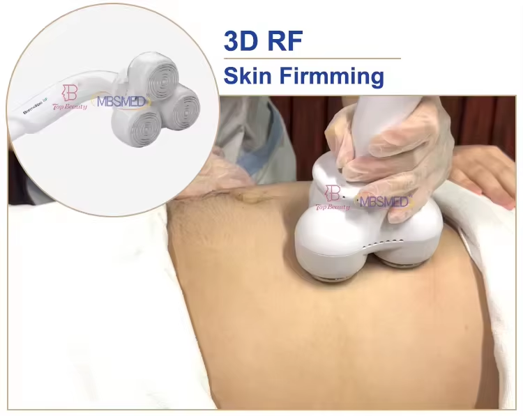 5 in 1 Cryolipolysys Fat Reduce 360 Cellulite Reduction Machine